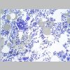 Medula osea SF 06.jpg